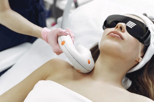Chemical Peels