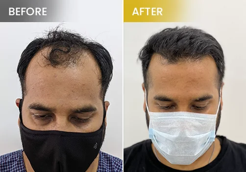 hair treatment before and after 1