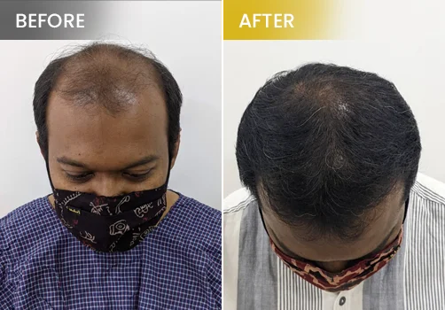hair treatment before and after 2