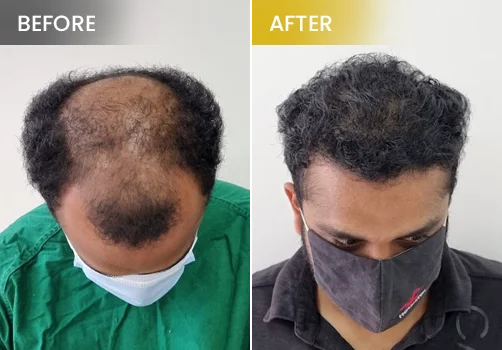 hair treatment before and after 3