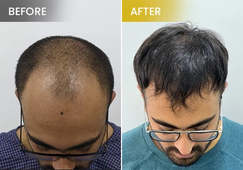 hair treatment before and after 4