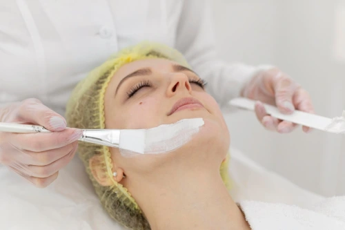 Acne Peel