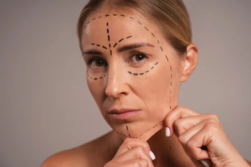Laser Hair Removal